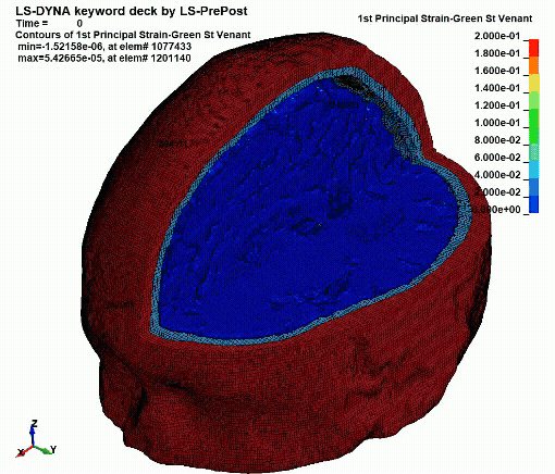Finite-element simulation showing brain strain